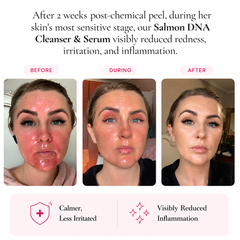 Salmon DNA- Hydrate, Repair & Glow