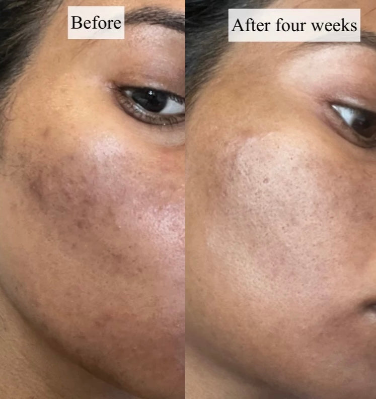 Bronwyn. D